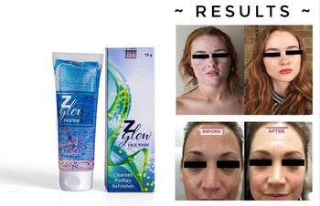 Z Glow Facewash 70gm, PACK OF 2