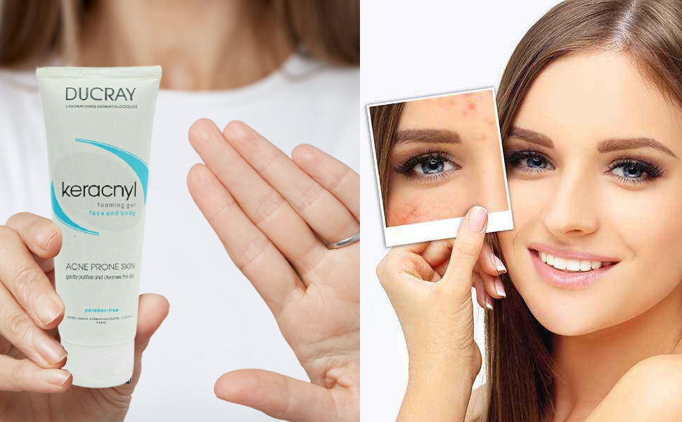 Ducray Keracnyl Foaming Gel, 100ml