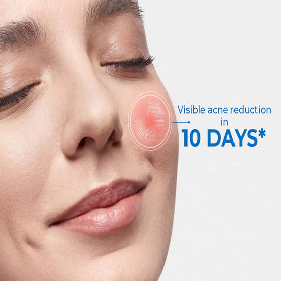 D Acne Foaming Face Wash, 60ml